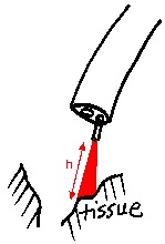 fiber retracted