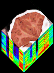 brain.gif