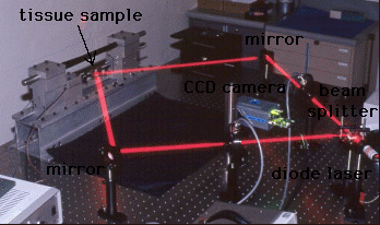 sean's laser